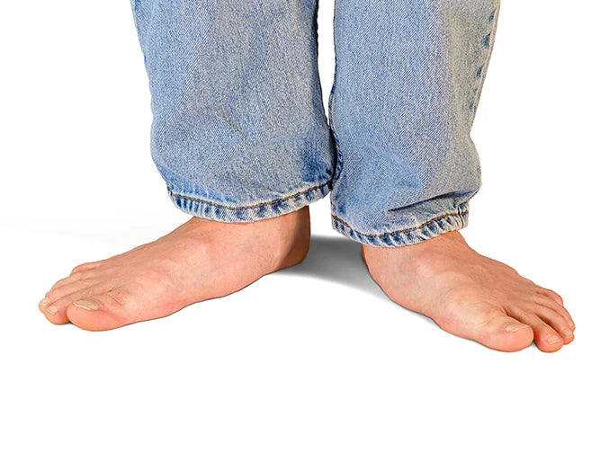 Understanding Flat Feet: Causes, Prevention, and Insoles.