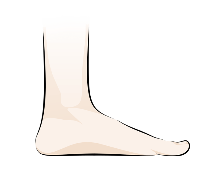 Flat Feet