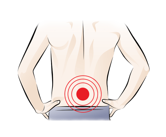 Low Back Pain