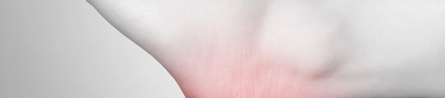 Foot Heel Pain